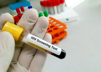 Dua Pelajar di Bintan Terinfeksi HIV, Total Kasus Mencapai 25 Orang