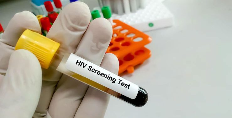 Dua Pelajar di Bintan Terinfeksi HIV, Total Kasus Mencapai 25 Orang